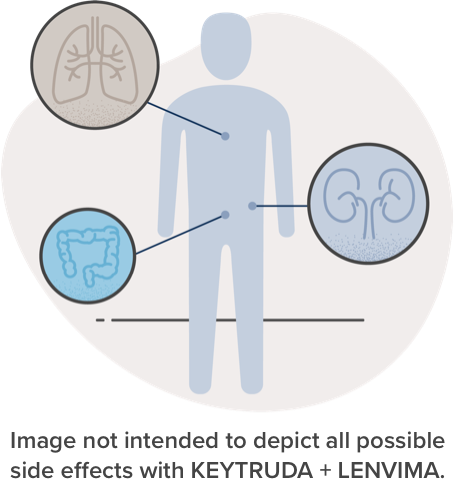 What To Know About Side Effects | KEYTRUDA® (pembrolizumab) And LENVIMA ...